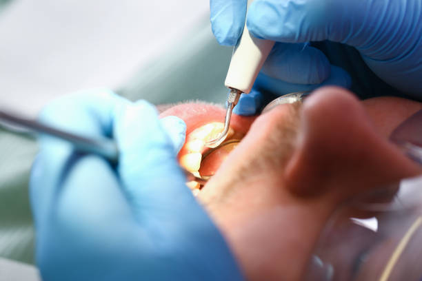 Best Emergency Treatment for Toothache in Tolar, TX