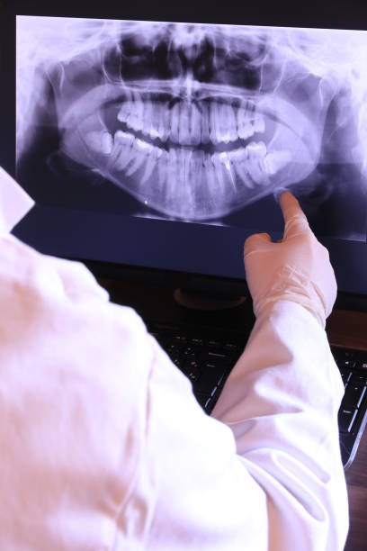 Best Emergency Tooth Extraction in Tolar, TX